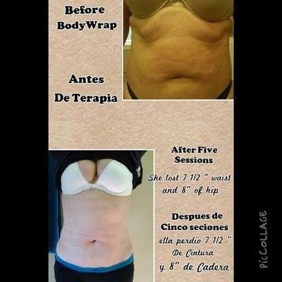 body wraps available for size reduction