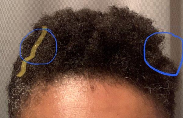 Blue circles = chunks clipped out of my hair Yellow highlight = unevenness of front of my hair because he said he was just cutting strays