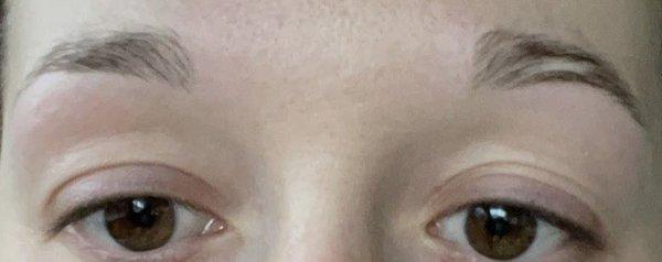 After: the whole start of my brows were removed for some reason.  Now they're extremely far apart.