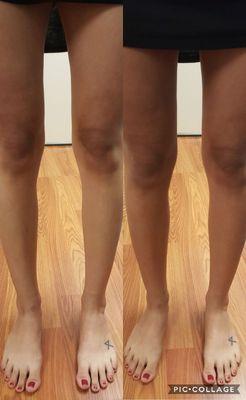 color correction.  client went to a game wearing ripped jeans. knees were tanned, used a darker shade, and avoided spraying the knee area