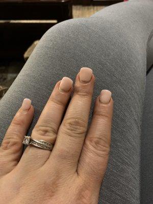 Uneven around cuticle