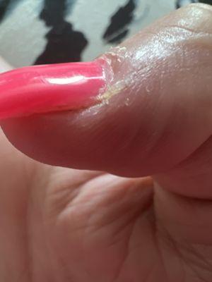 Uneven nail