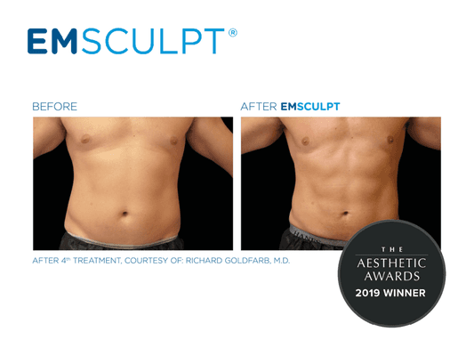 These results are astounding. Emsculpt helps you build muscle to tone and tighten the core! 2000 situps WON'T give you results like this.