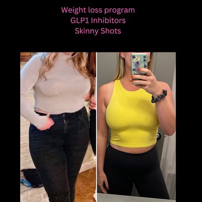 Semaglutide weight loss program