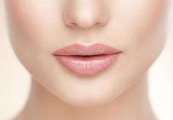 LipLase - Laser lip enhancement