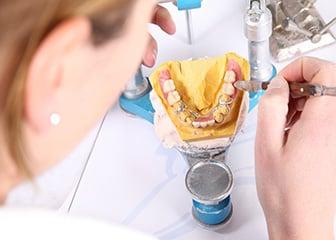 Creative Dental Lab