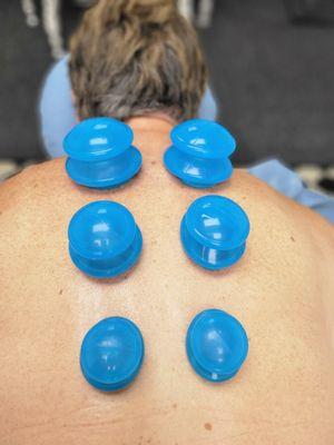 Cupping