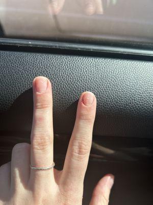 My finger nail