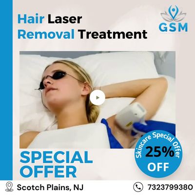 laser hair removal