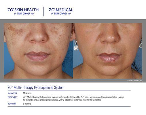 ZO Skin Health by Dr. Zein Obagi