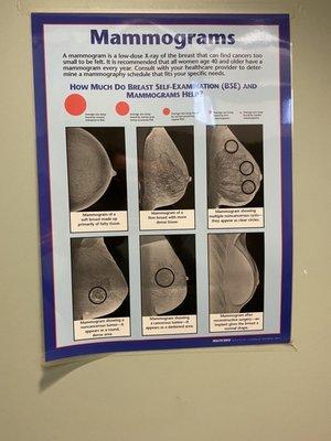 Mammograms vs. Breast Self-Examinations