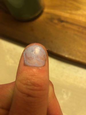 I just got these done at 6:30-7 PM AND THIS is what my nail looks like.