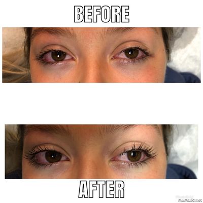 Lash Lift