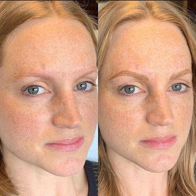 Get your face back with Microblading!