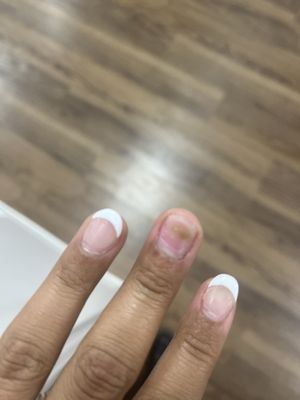 I have been getting my nails done for years and never had an issue. I come here a few times and end up with a fungus!