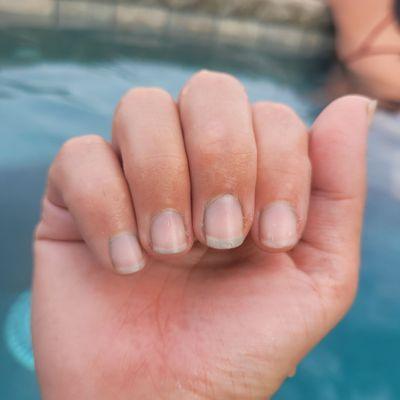 Blue fingernails from the hot tub