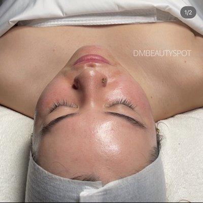 Achieve the glow with the hydro deluxe facial