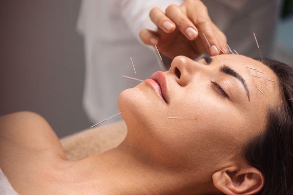 Facial acupuncture