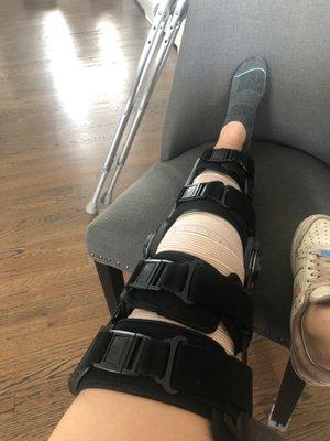 ACL reconstruction surgery