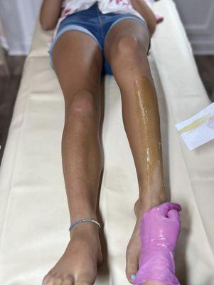 Swipe to see the different stages of a leg wax 

https://www.instagram.com/p/CtRZ3ogLagd/