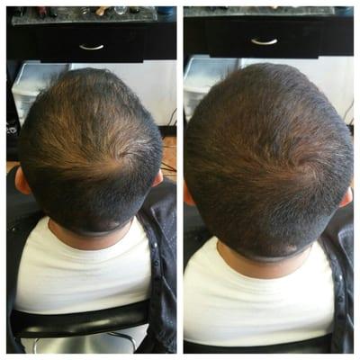 Hair micro fibers. Before and After