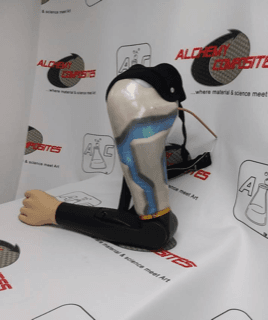 Upper Extremity Prosthetic Device