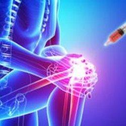 Arthritis PRP Stem Cell Therapy - Orthopedics