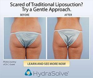 Liposuction for Buttocks