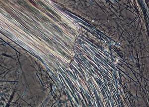 Asbestos Fibers Under a Microscope