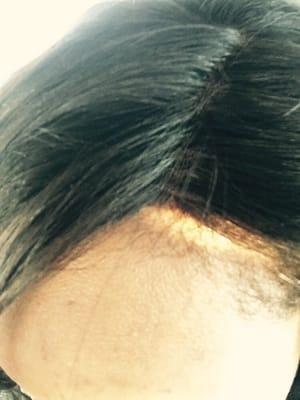 What Sharita did. You should see my scalp but she placed a black cap under the closure and no leave out as requested