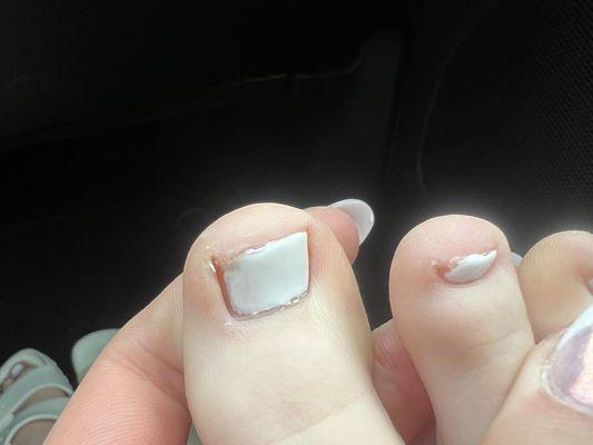 again toenail half painted ( ignore my ugly toes)