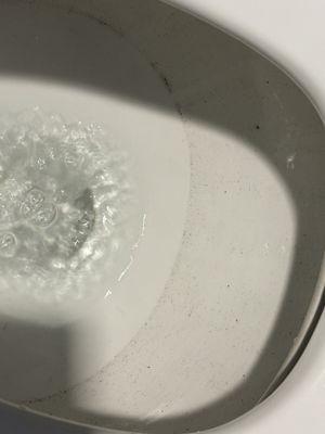 Mold growing in the toilet. When are these being cleaned?!