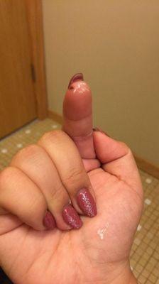 I couldn't get it to focus and excuse the white paint on my finger but that's the cut I got from the nail file