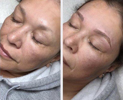 Before & After Microblading