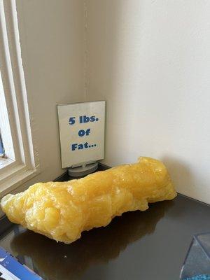 This is 5 pounds of fat!