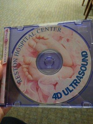 Ultrasound cd for 4d appointment