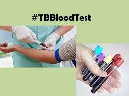 TB Test