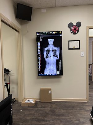 Large screen to view digital X-rays