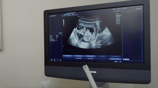 2D ultrasound