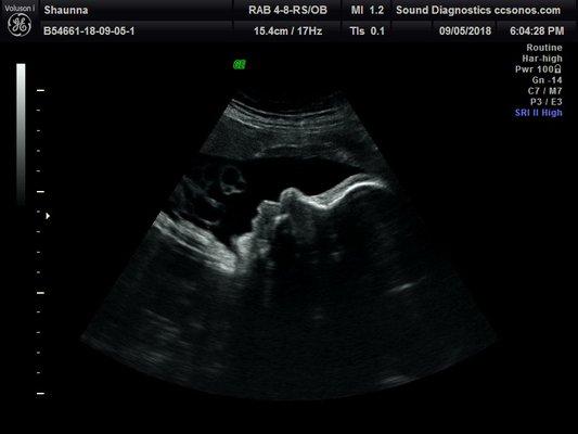 36 Week 2d profile