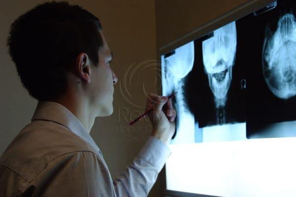 Dr. Jay analyzing for the exact misalignment. Even 1 degree makes a difference for your exact correction!