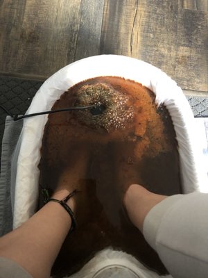 End of Ionic Foot Detox (approx 30 min)