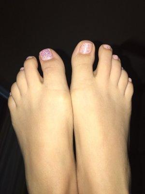 They had to put a powder on my left big toe due to a split toe nail, so that's why it looks wonky.