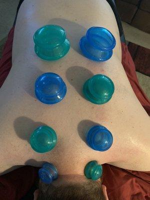 Upper back cupping