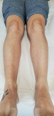 Get yourself ready for the summer with a lower leg wax!