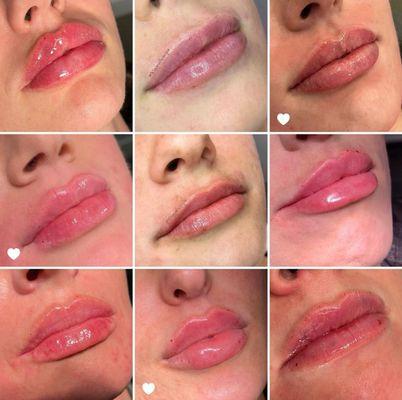 Find your "perfect pout"