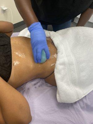 Ice treatment with cavitation