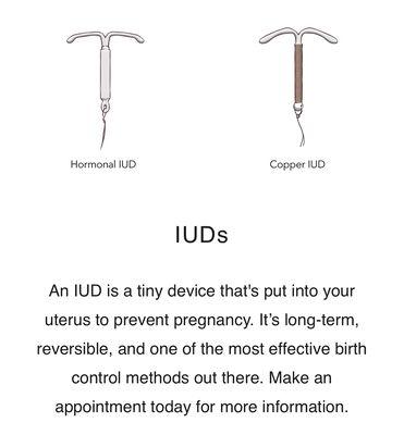 We can insert an IUD to help prevent a pregnancy.