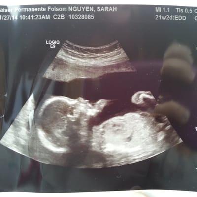 My baby girl at 21 weeks