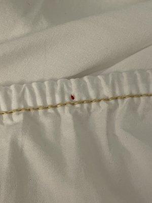 Blood red bed bug at the Hotel Venezia room 259